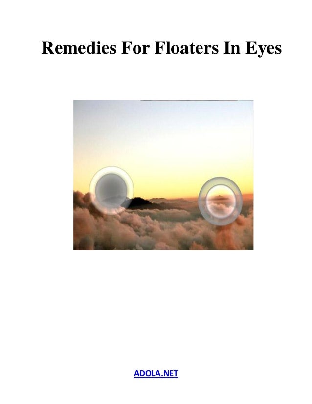 Remedies for floaters in eyes