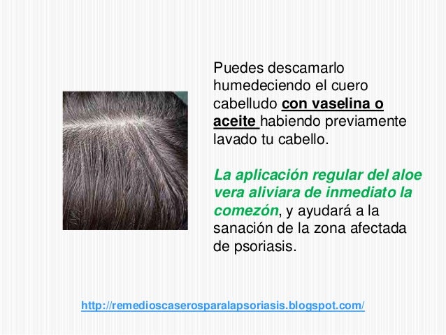 No la crema no hormónica de la psoriasis