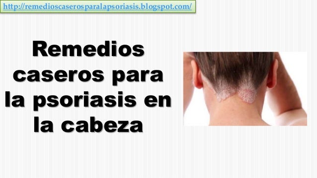 El tratamiento de la eccema en belarusi
