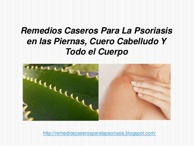 La crema china de la psoriasis yiganerjing hormónico o no