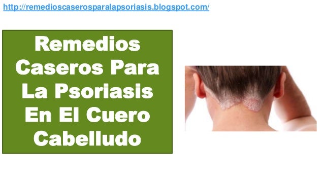 De la citoestática los preparados a la psoriasis
