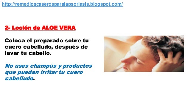 El tratamiento de la psoriasis en moskve y la esfera de Moscú