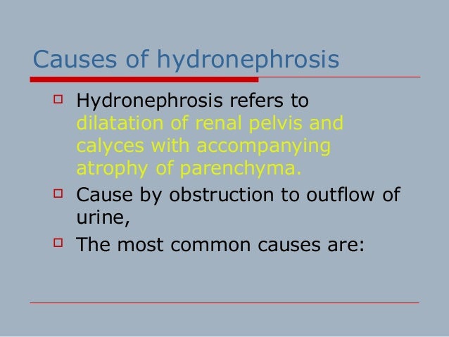 Renal calculi and hydronephrosis
