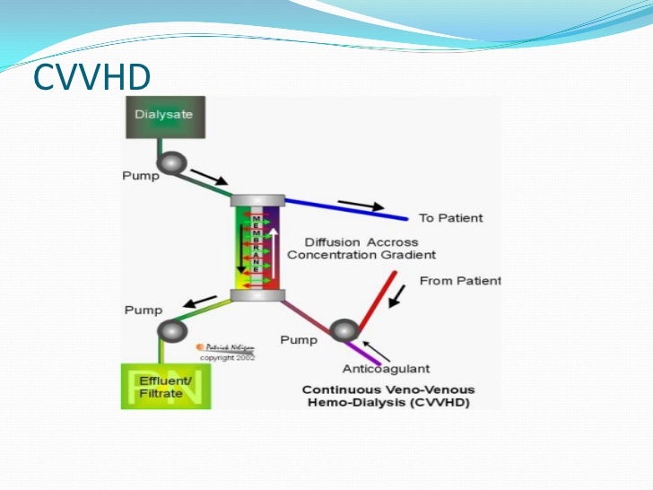 Advantages And Disadvantages Of Renal Replacement Therapy