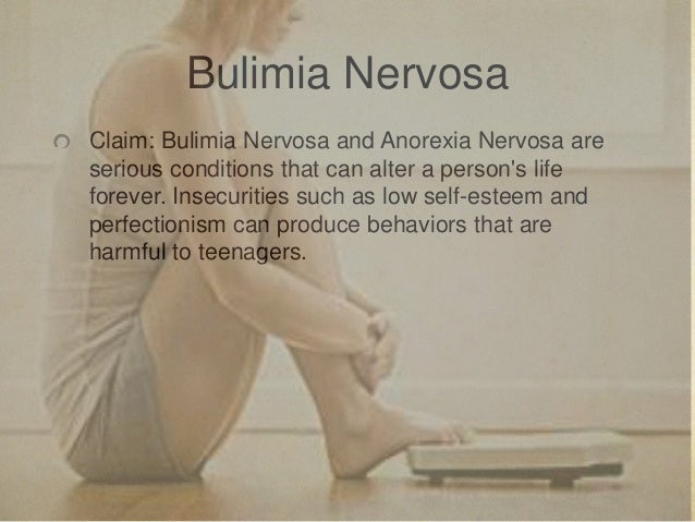 Bulimia nervosa essay writing help, research papers 