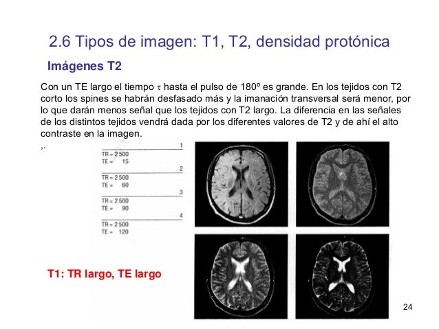 los diferentes tipos de IRM con contraste