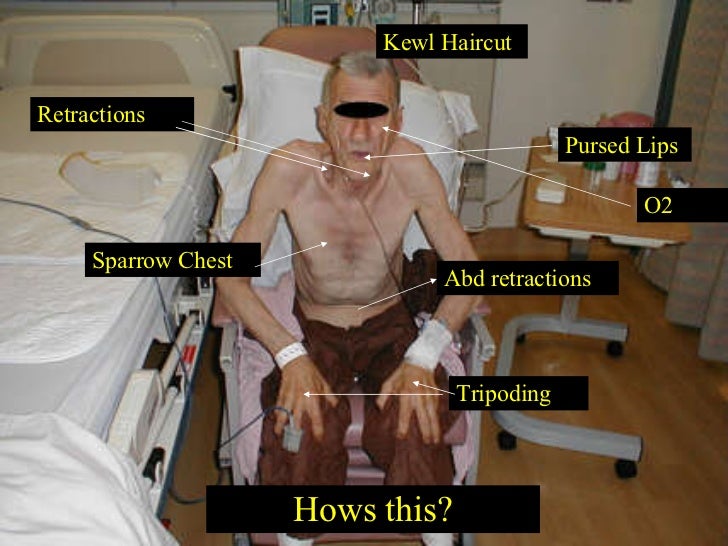EMS Respiratory Emergencies (Again)