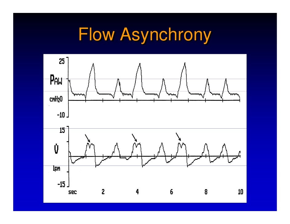 Respiratory Mechanics