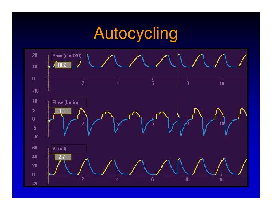 Respiratory Mechanics