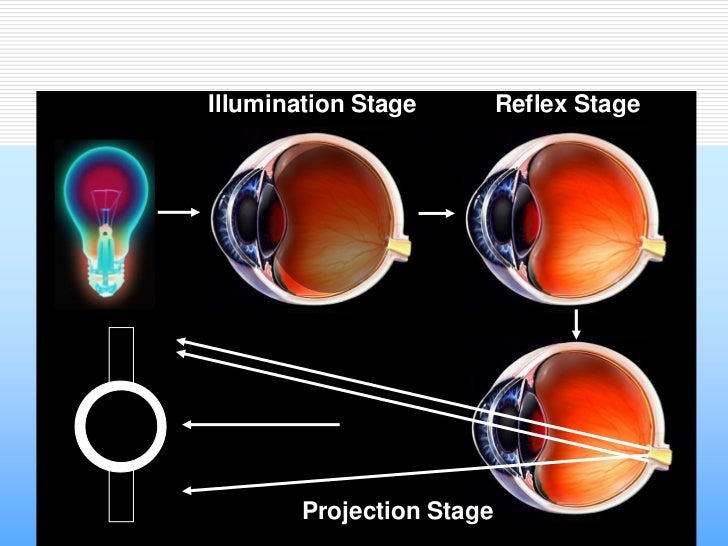 Refraction and Retinoscopy