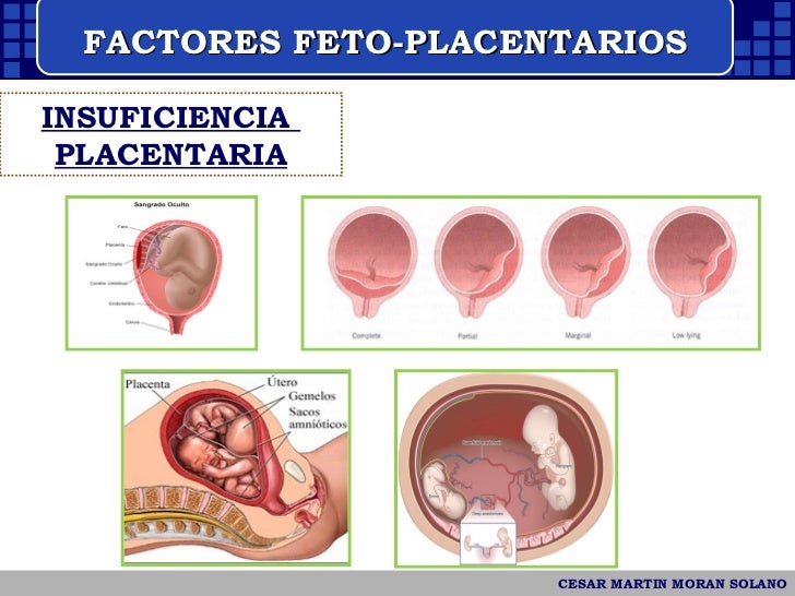 Retardo del crecimiento Intrauterino 2009