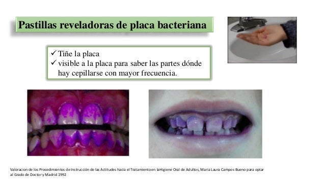 Ha dejado a fumar ha engordado que hacer