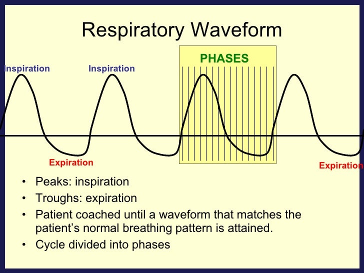 Respiratory Gating with IMRT