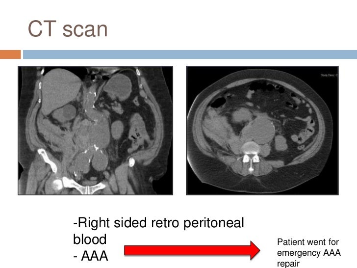 dialysis nursing care ppt kidney characteristic of one.4
