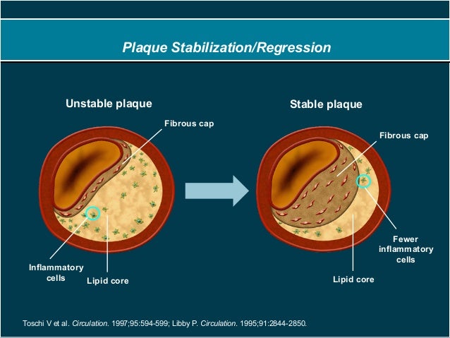 hemorrhagic stroke long term outlook ischemic stroke control uptodate