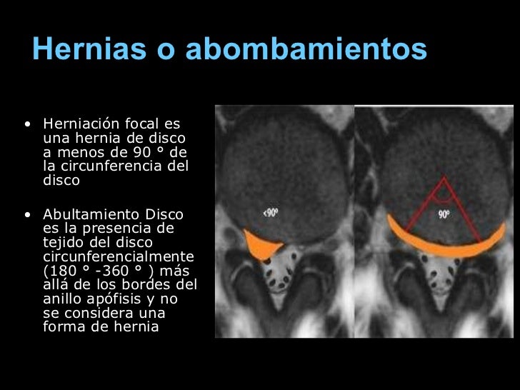 Por qué a las mujeres a mediados de ciclo duele la parte inferior del vientre y el dolor en los riño
