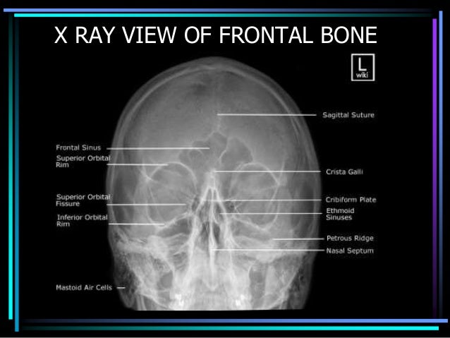 Roentgenology of skull