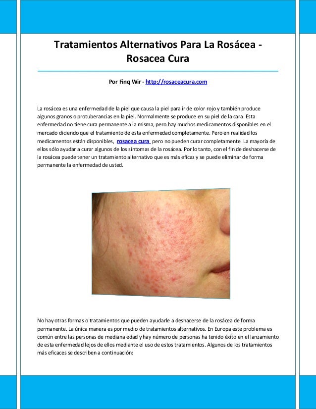 Rosacea cura