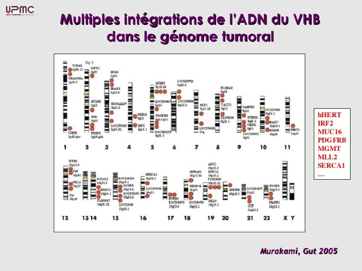 Carcinome Hepatocellulaire Sur Cirrhose