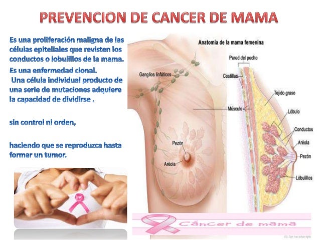 Tumor benigno de mama se puede convertir en maligno