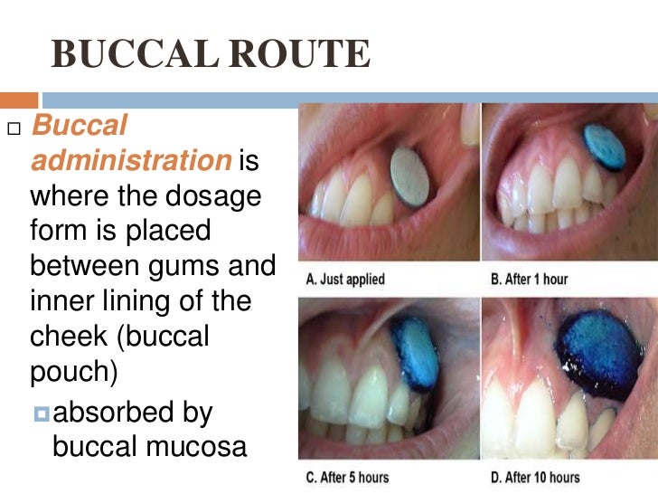 Routes of drug administration