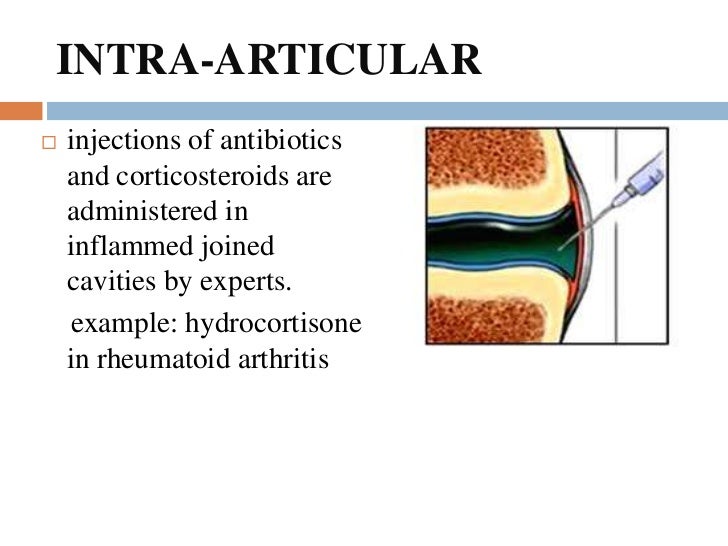 Routes of drug administration