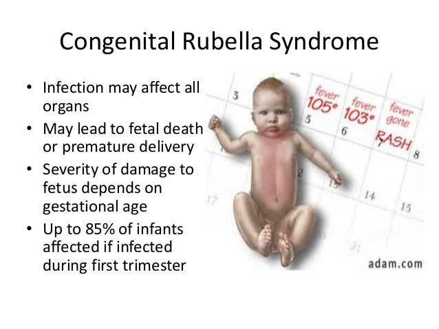 Congenital rubella syndrome symptoms in adults