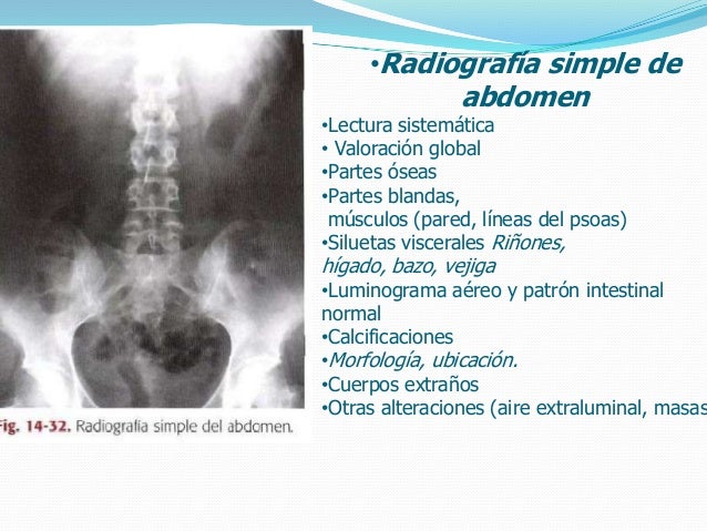 Rx abdomen a r