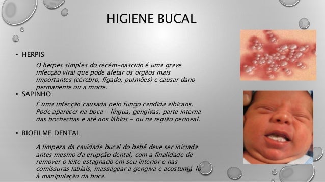 Agapkin sobre um fungo de duração de pregos