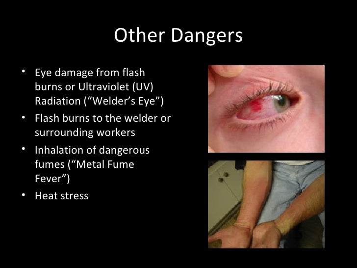 underwater welding