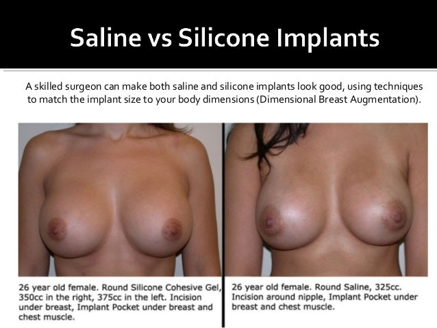 Saline Vs Silicone Gel Implants 105