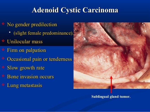 Cancer treatment Radiotherapy Chemotherapy surgical procedure