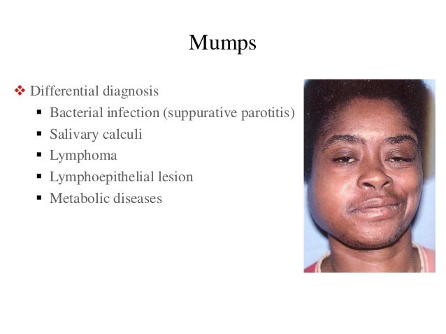 salivary gland pathoology 1 parotid swellings