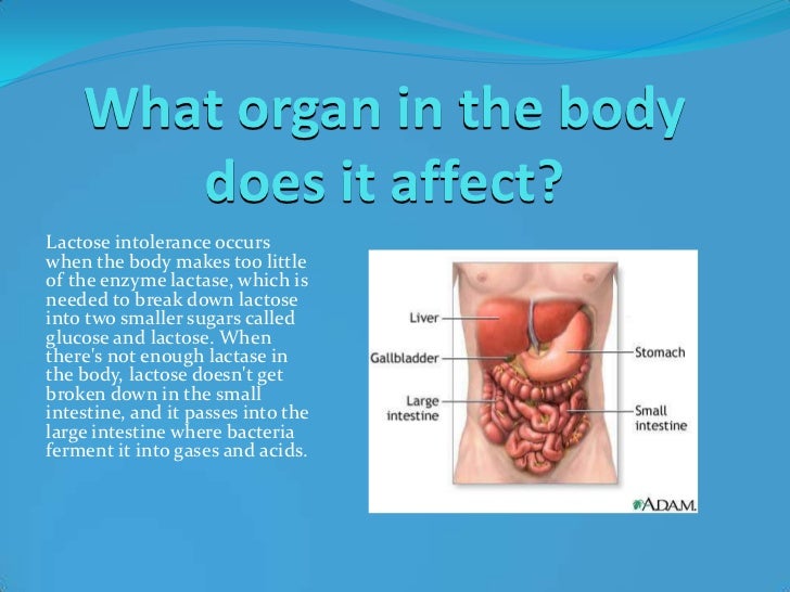 Lactose Intolerance Student Presentation lactose-intolerance-student-presentation