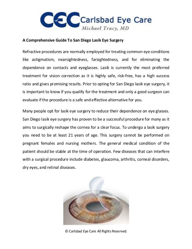 san-diego-lasik-eye-surgery-a- ...