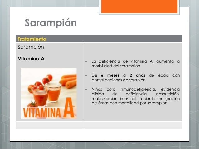 Sarampión