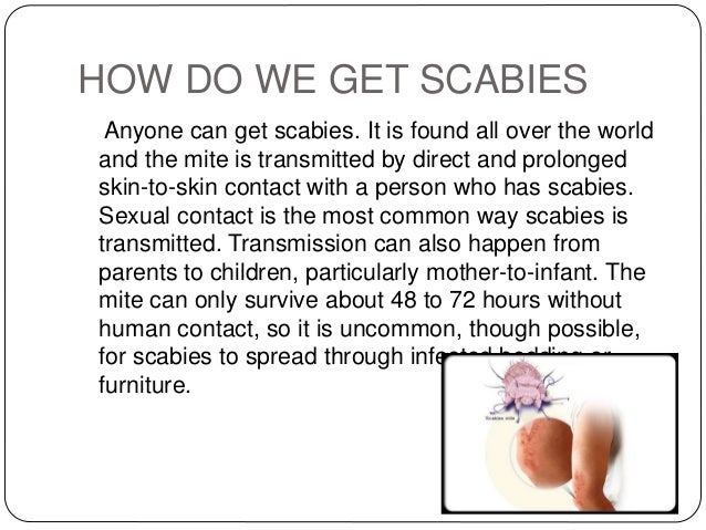 Scabies Bites: Pictures, Symptoms, and Treatments