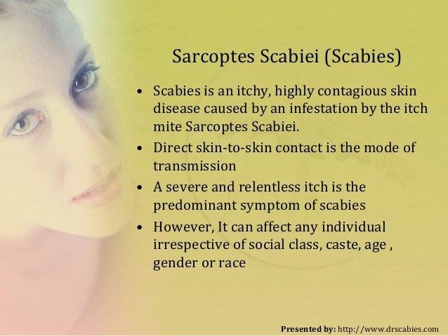 how-to-kill-scabies-all-think-to-know-2-