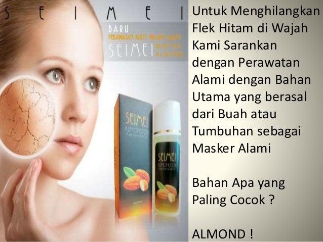 Cara Merawat Wajah Dari Flek Hitam Secara Alami