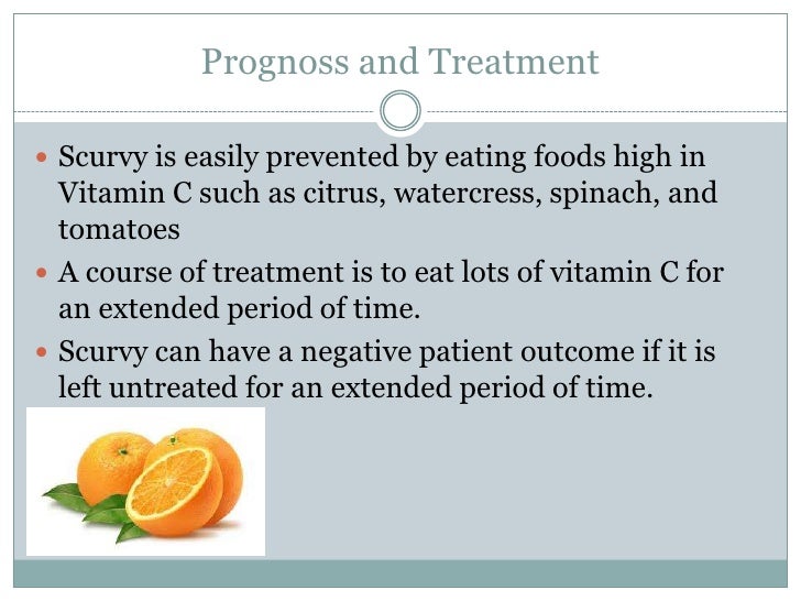 7 Signs You May Have a Vitamin D Deficiency forecast 7 Signs You May Have a Vitamin D Deficiency advise