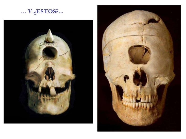 secretos secretos