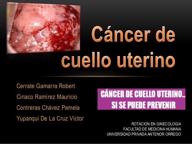 is cervical most cancers absolutely curable