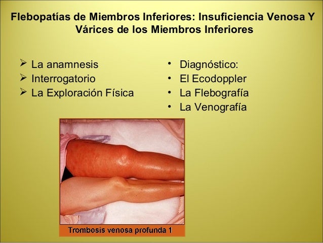 El cáncer matki y la trombosis