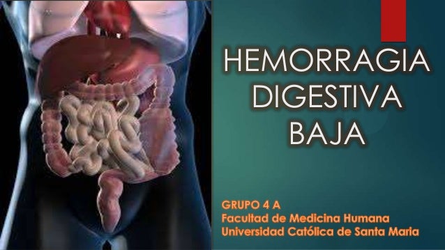 HEMORRAGIA DIGESTIVA BAJA hemorragia digestiva baja: