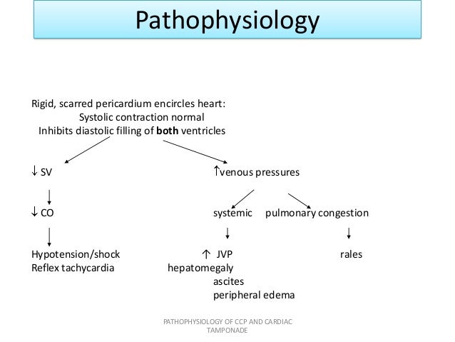 Dialysis Hypotension