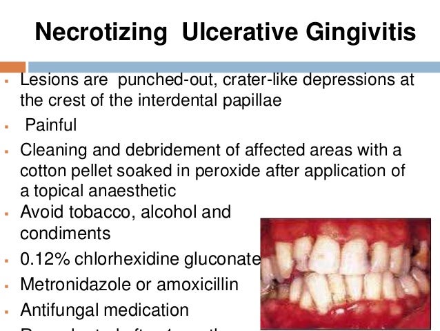 Necrotizing Periodontal Diseases - Foundations of ...