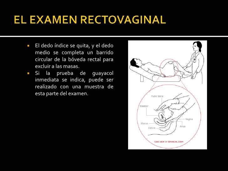 EL EXAMEN CON ESPÉCULO: Como el proyecto de ley espéculo es insertado totalmente, es en ángulo de 30 º hacia abajo p...