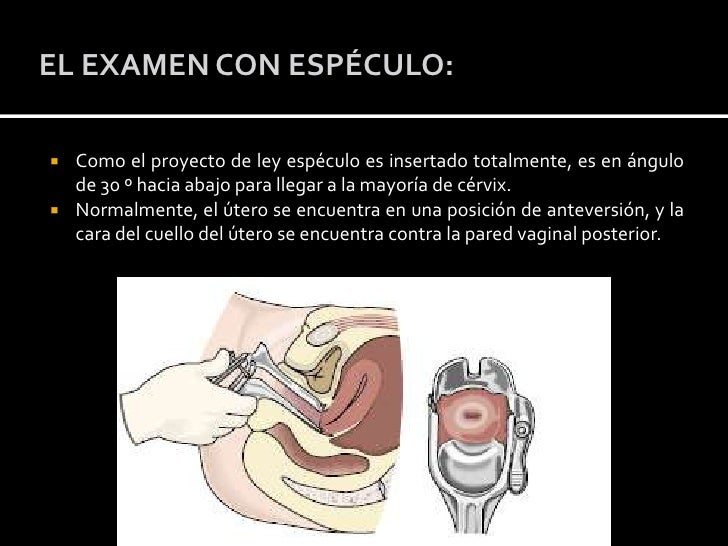 Semiología aparato genital femenino(examen ginecologico)