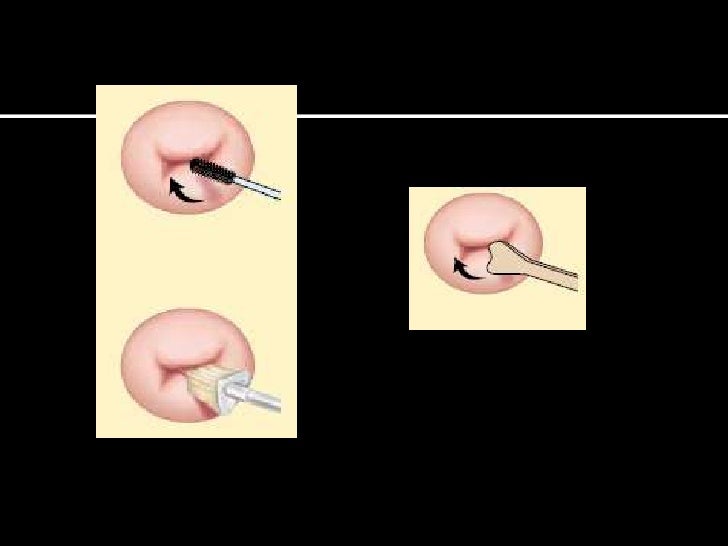 Semiología aparato genital femenino(examen ginecologico)