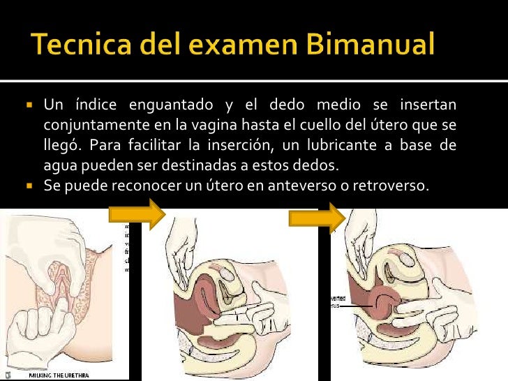 El dedo índice se quita, y el dedo medio se completa un barrido circular de la bóveda rectal para excluir a las masas...